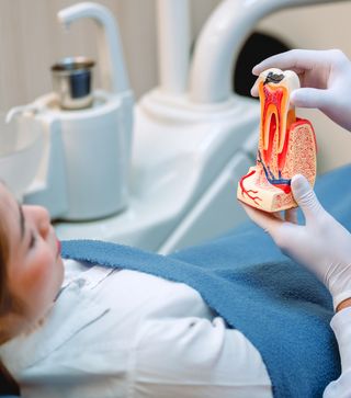 Endodontics Root Canal