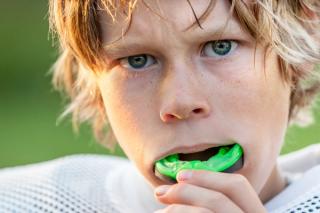 Do dentists make mouthguards?