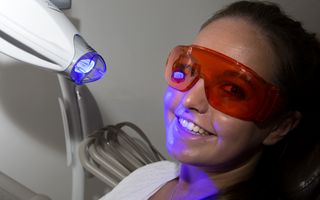 In-chair teeth whitening example