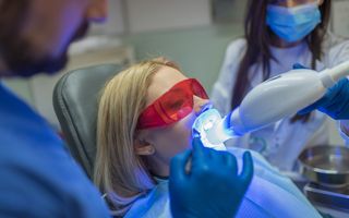 In-chair teeth whitening example