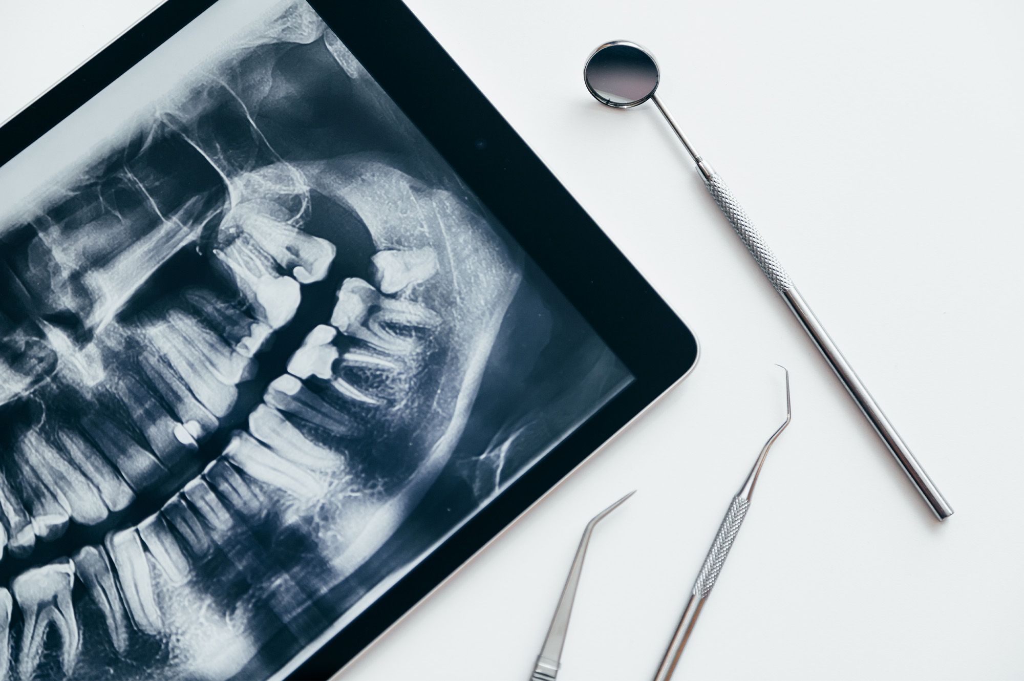 A full dental examination