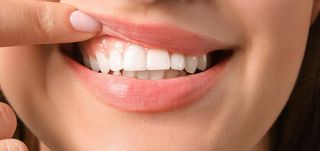 Healthier Gums, Stronger Smiles