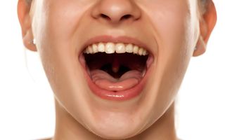 Dry mouth