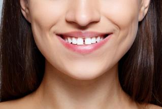What Can Clear Aligners Fix?