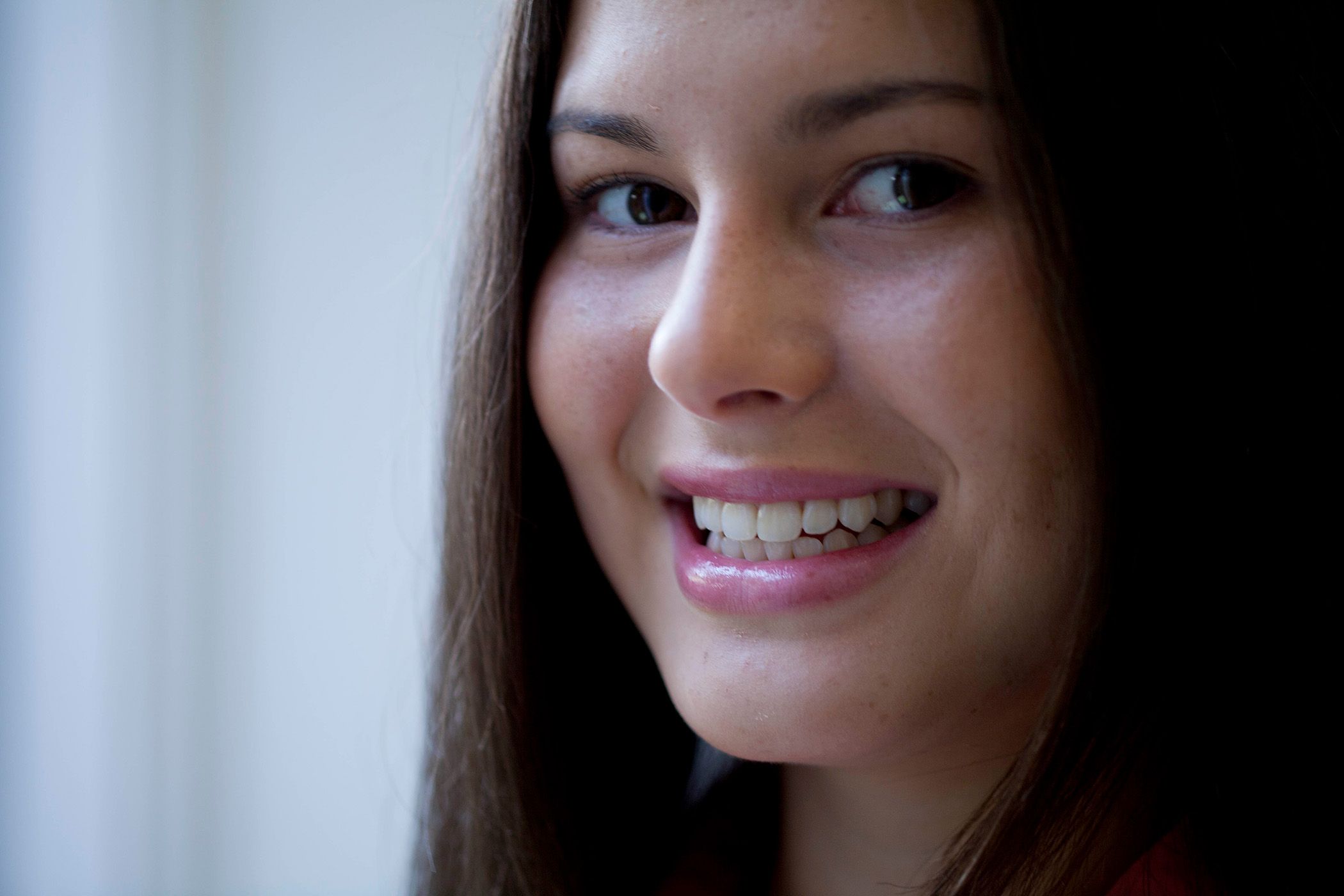 Image of a patient smiling showing her teeth.