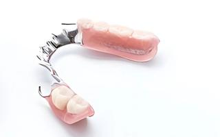 Partial Dentures