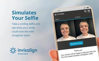 Promotional image of Invisalign's SmileView Simulation tool.