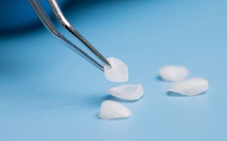 Veneers being inspected by dentist prior to application