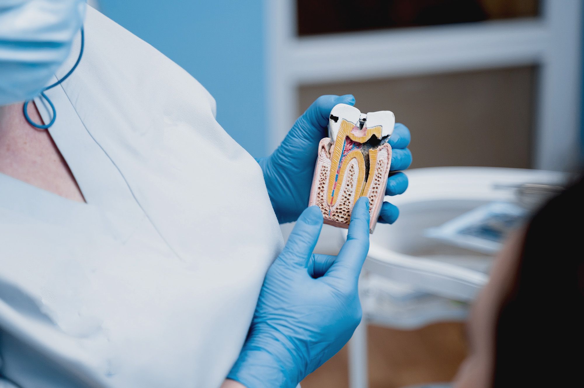 Endodontics (Root Canal) - Hero