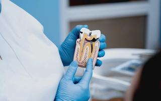 Endodontics (Root Canal) - Hero