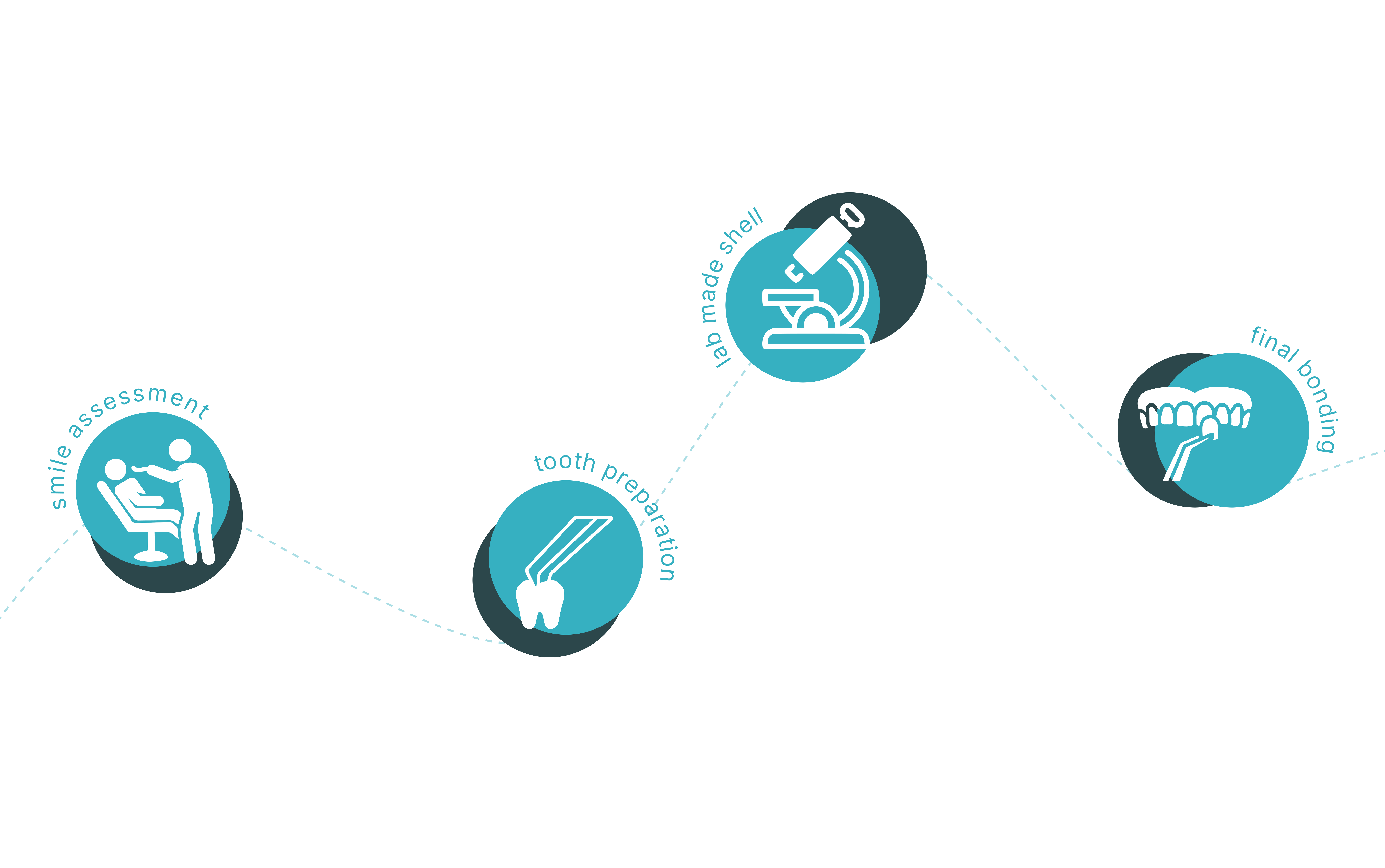 Process of porcelain veneers (indirect veneers)