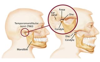 TMJ Dysfunction displayed