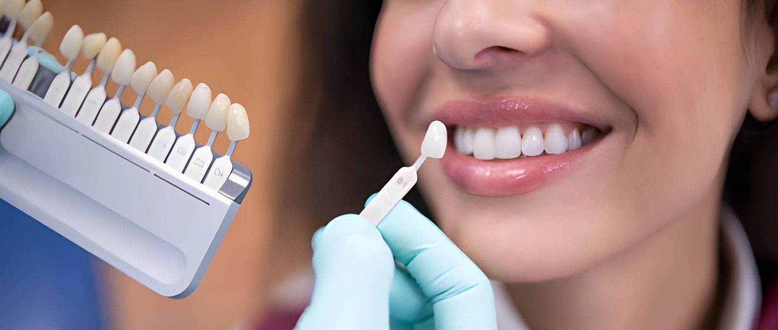 Enhance Your Smile with Custom Veneers