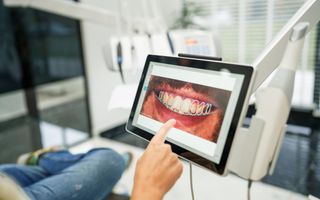 Smile Design software