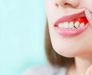 What does a periodontist do?