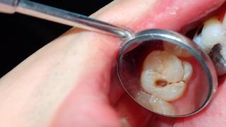 Why Oral Hygiene Matters?
