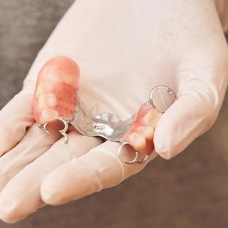 Partial Dentures