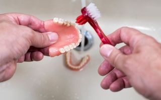 Dentures VS All-On-4 Implants