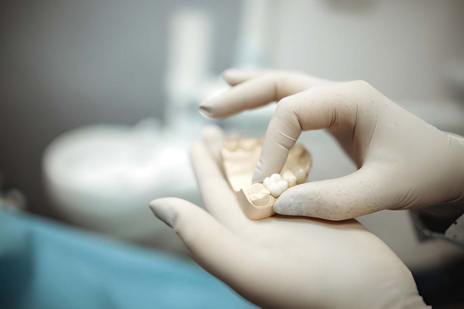 What is a dental crown?