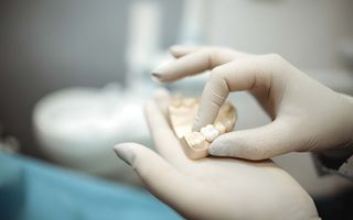 What is a dental crown?