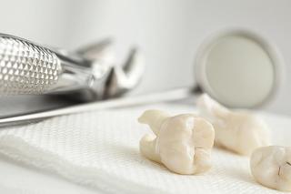 Tooth extractions