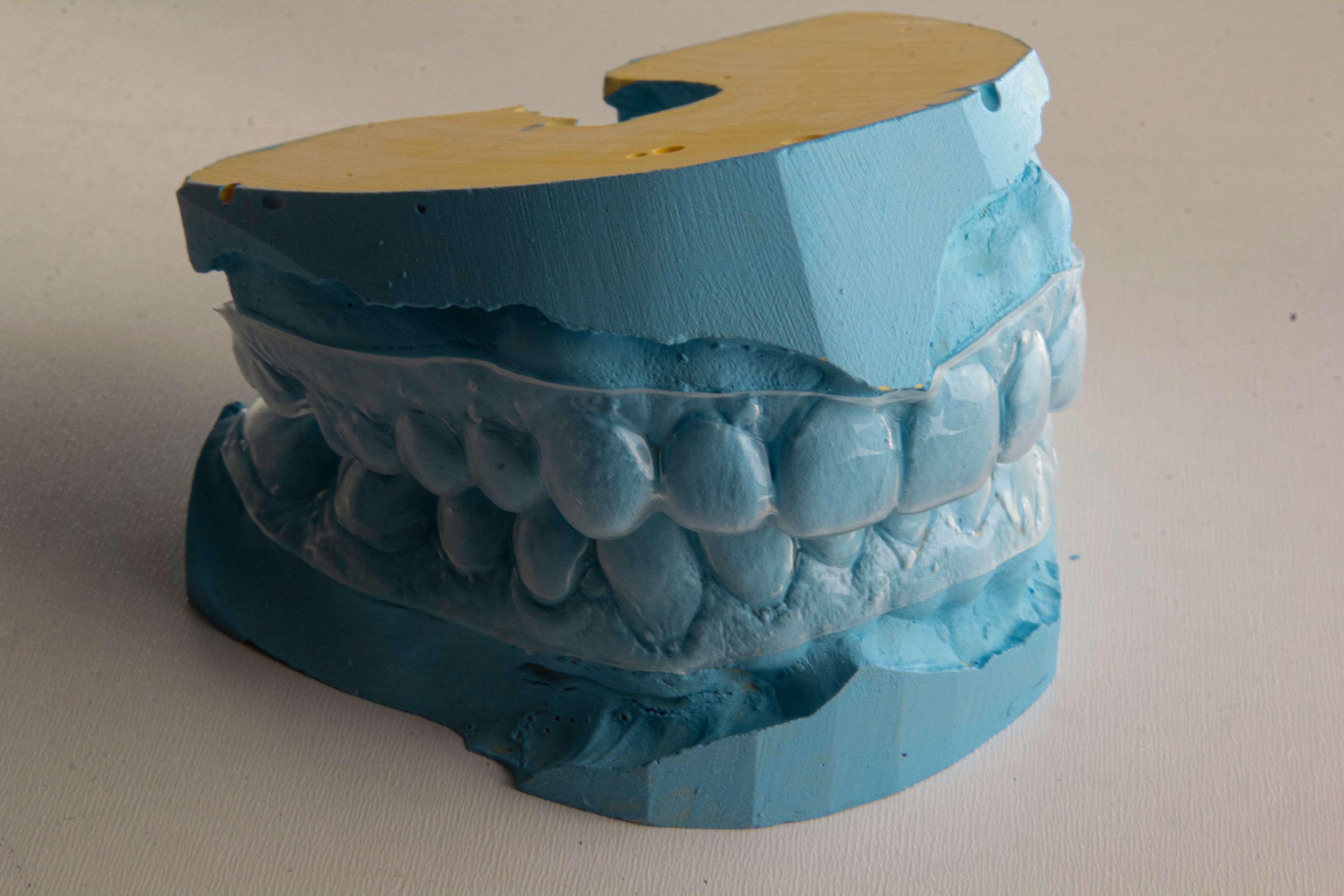moulds