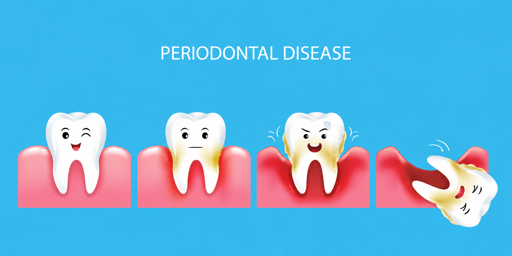 periondontal disease