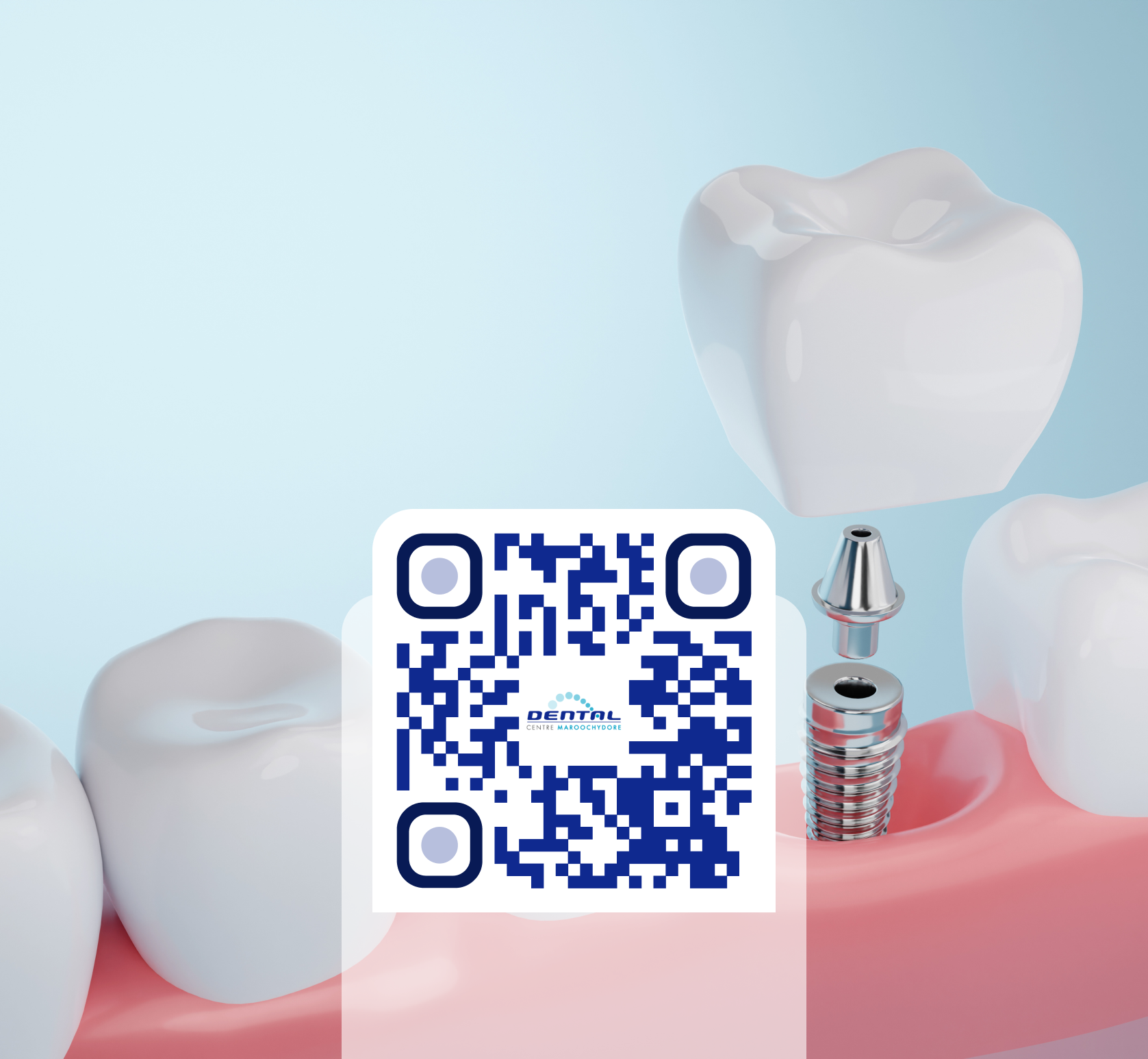 implants - consent form qr code