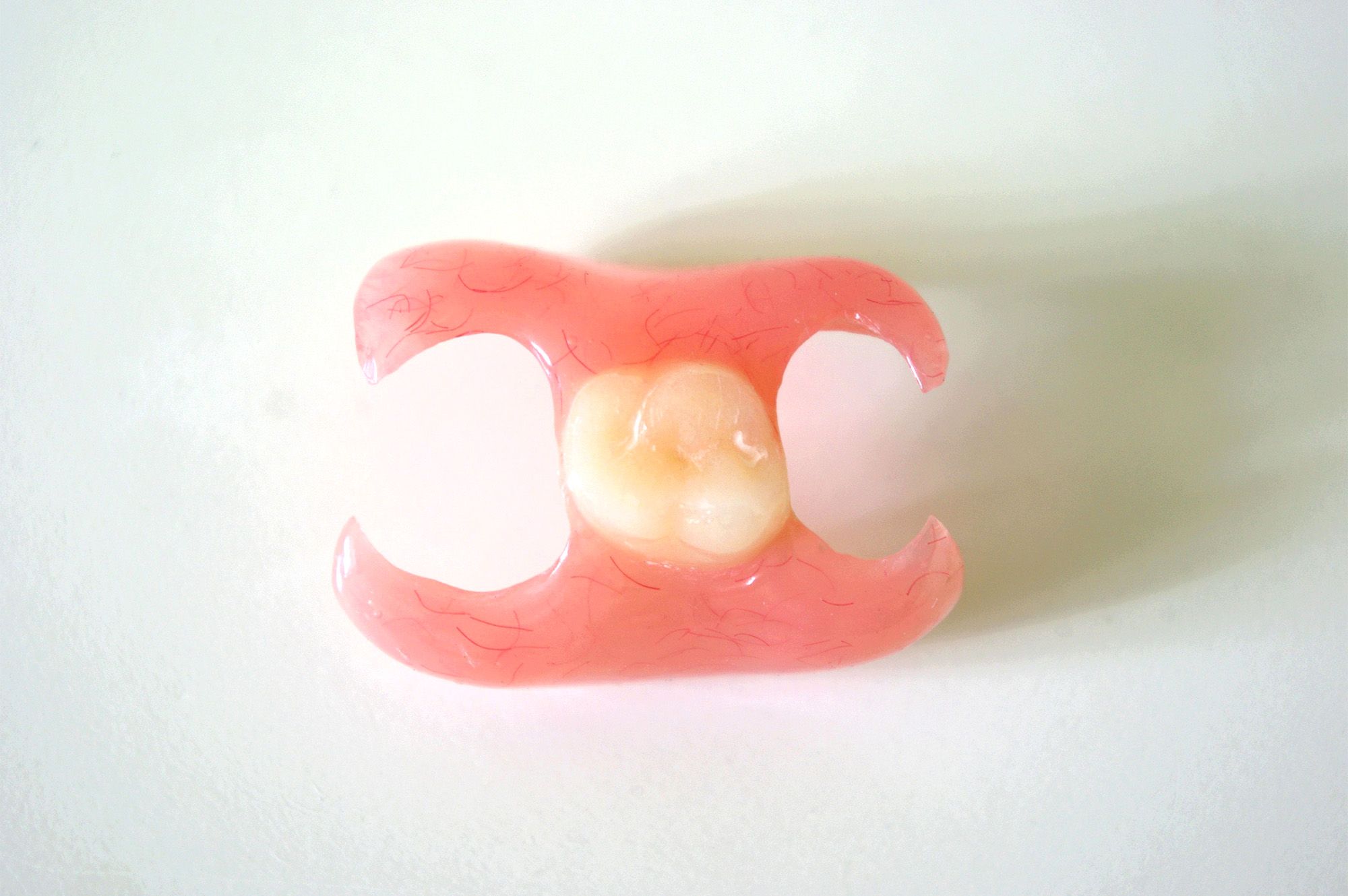 Immediate Dentures