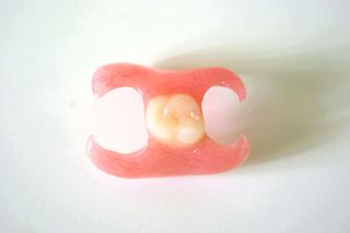 Immediate Dentures