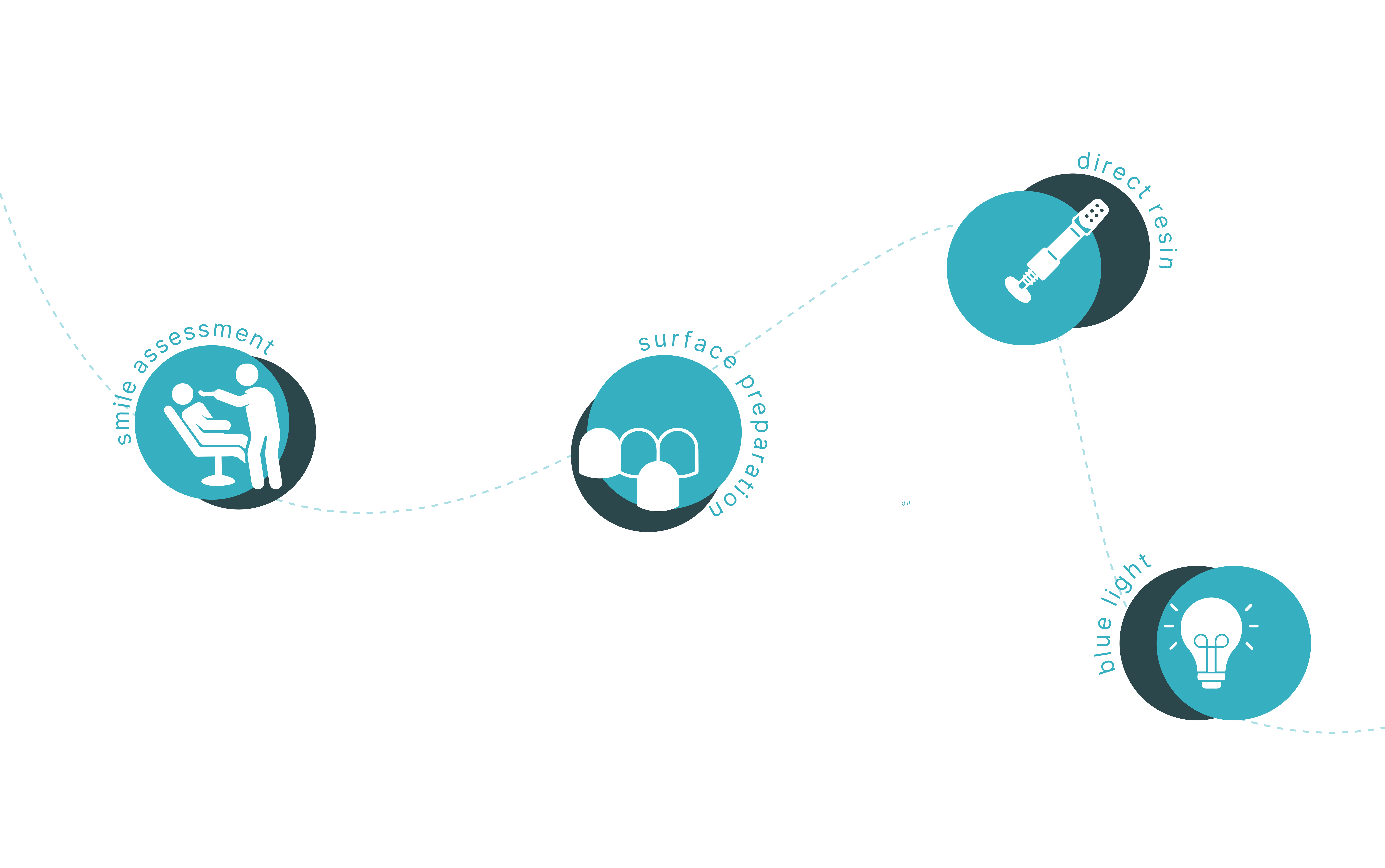 Process of composite veneers (direct veneers)