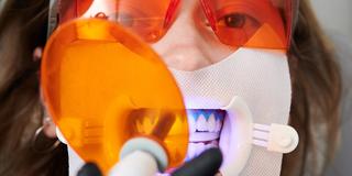In-Chair Whitening — Results in a Single Appointment