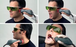 the stages of laser treatment on a male patient