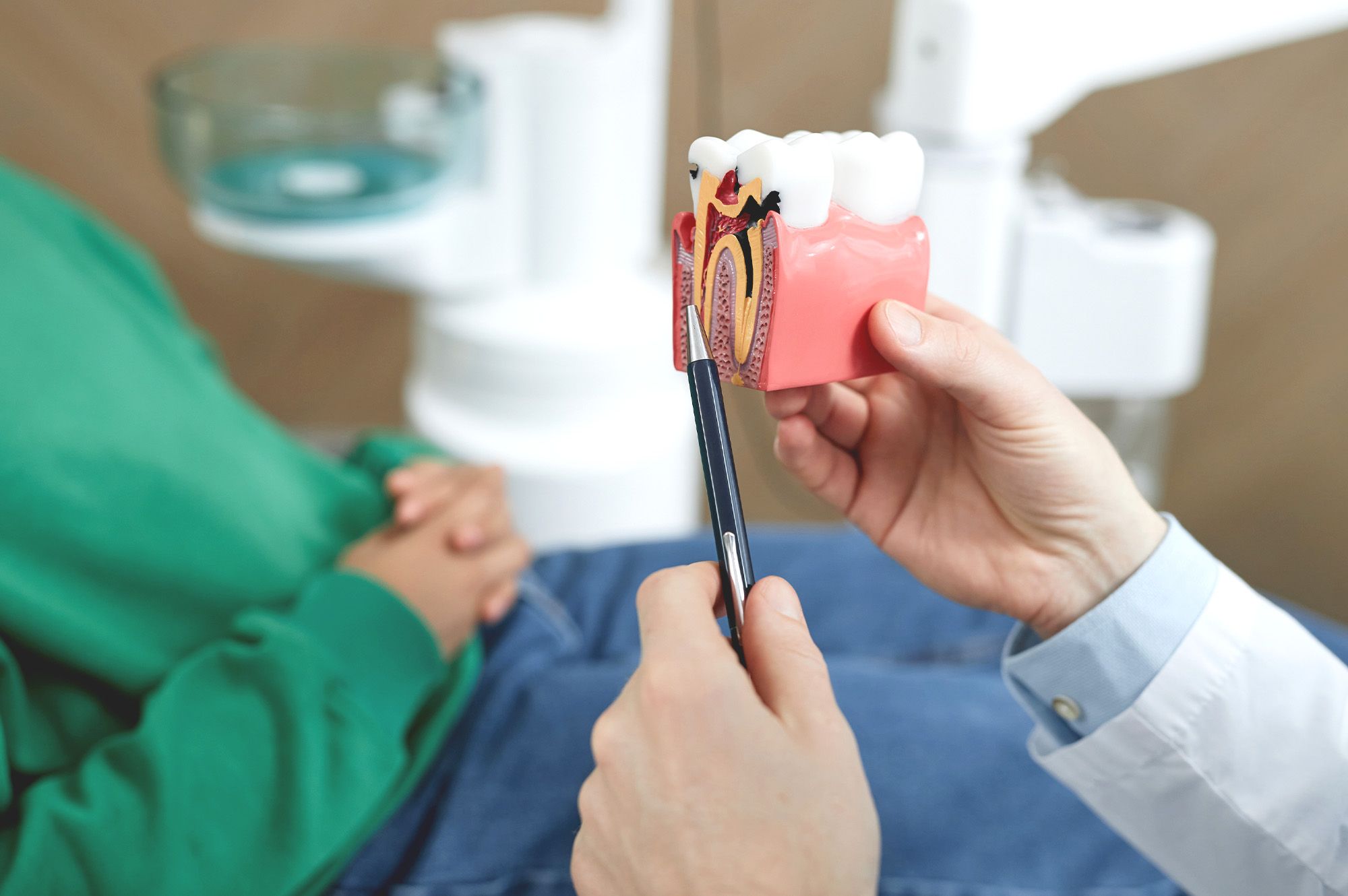 What Is a Root Canal?
