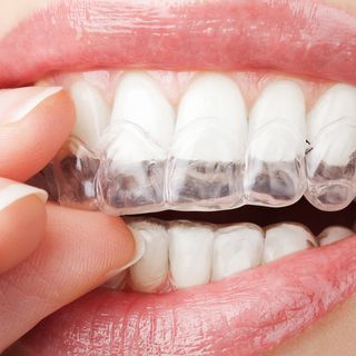 Invisalign®