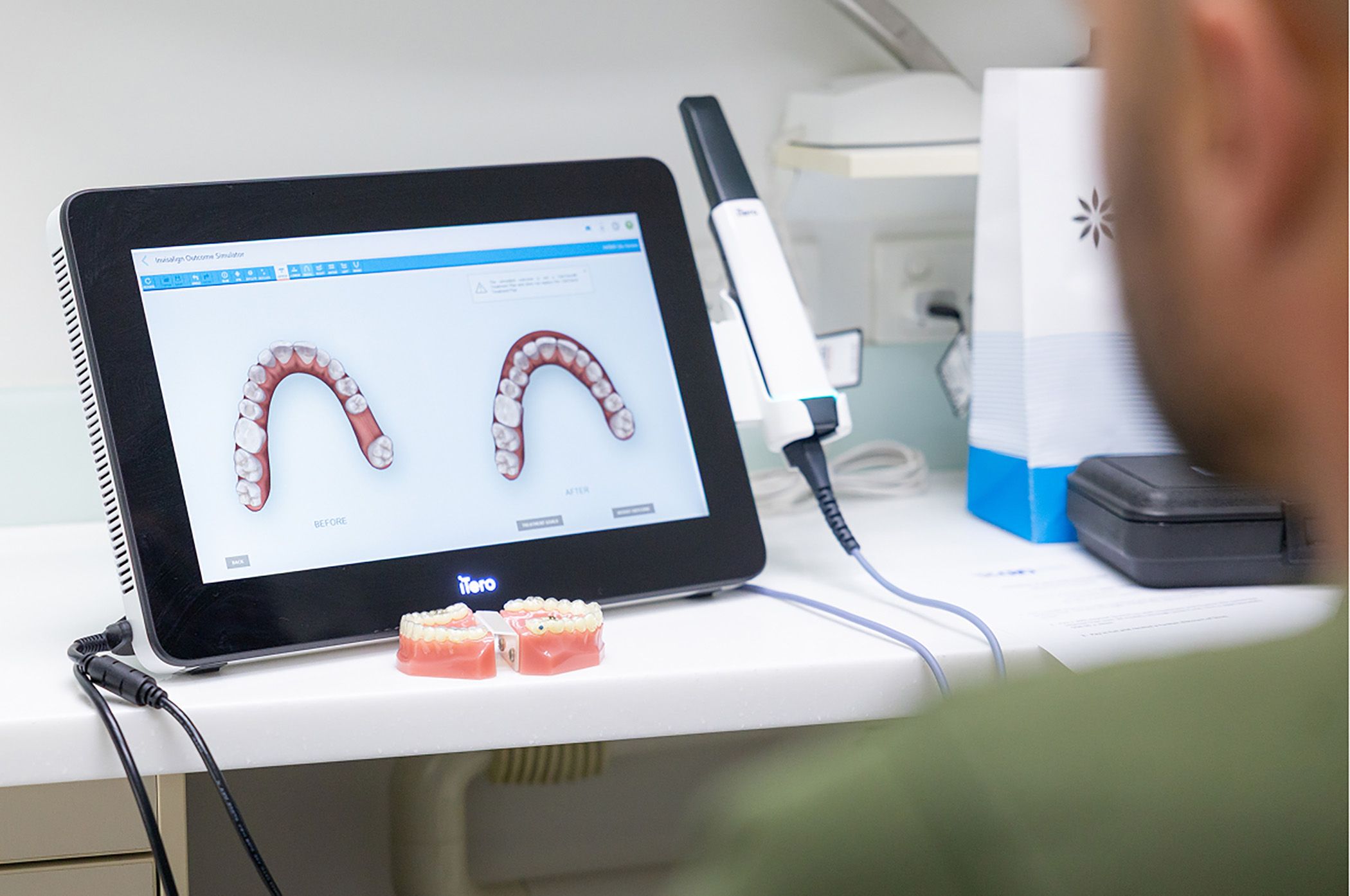 What to expect at CBD Dental