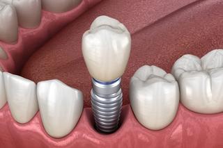 Single tooth