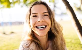 Quality Dental Braces in Werribee
