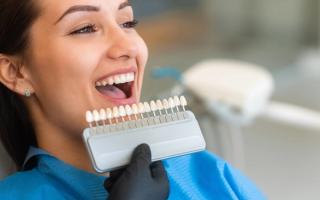 Image of a female going through a teeth whitening assessment.