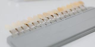 Is Whitening Right for Me?