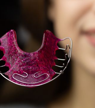 What Happens If You Stop Wearing Your Retainer?