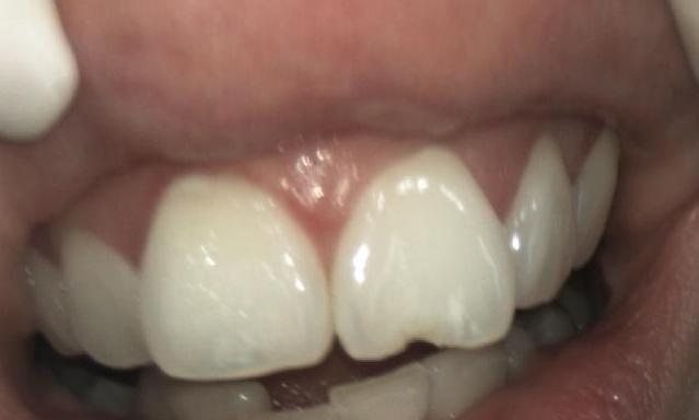 General Dentistry - Before