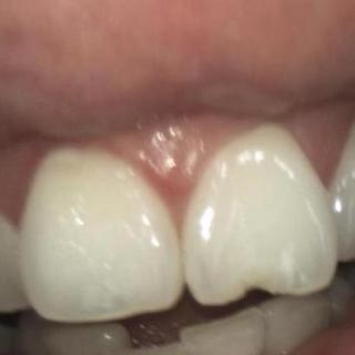 General Dentistry - Before