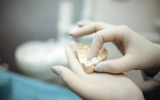 Restore your smile with Dental Crowns