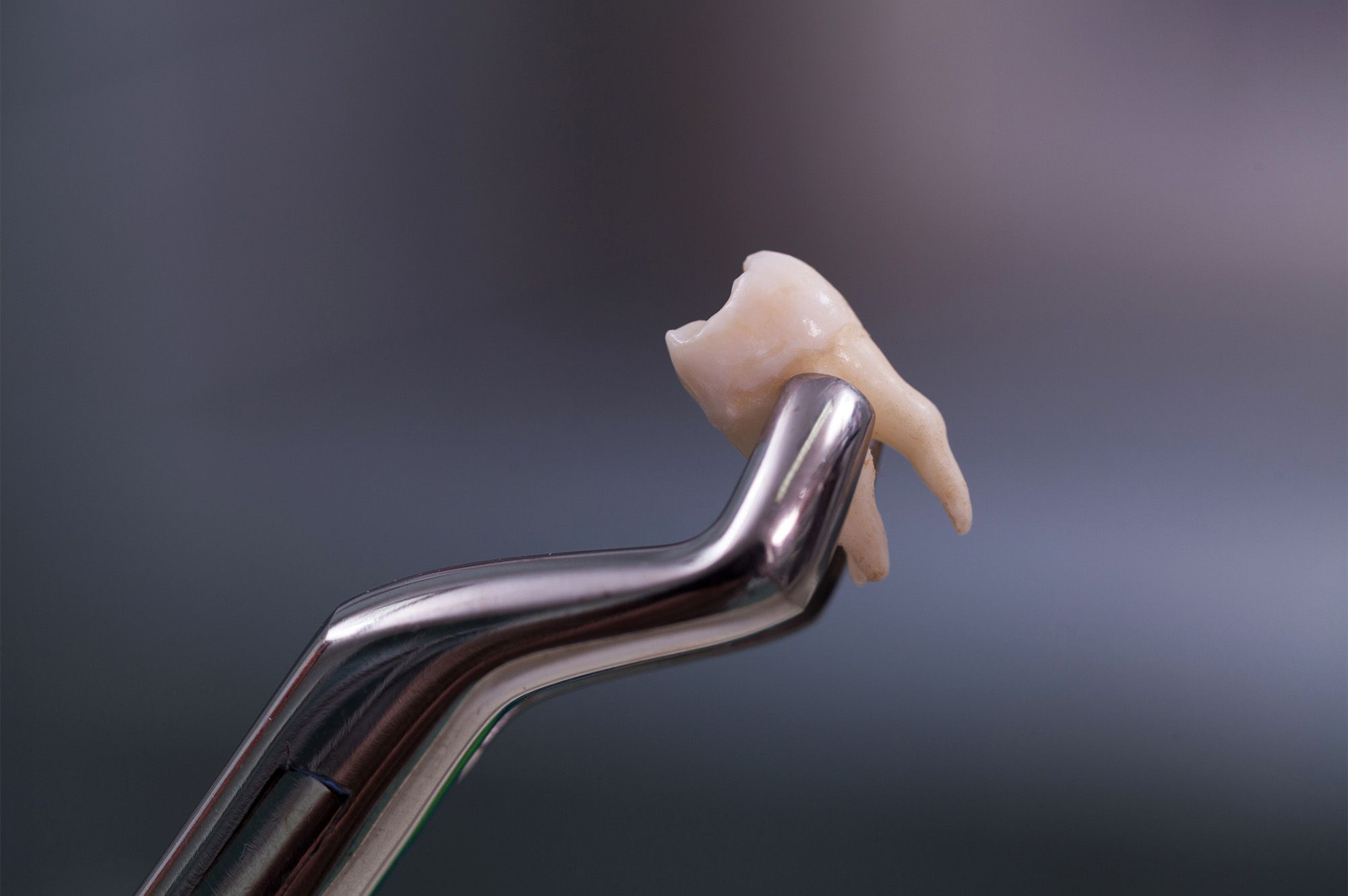 Extractions