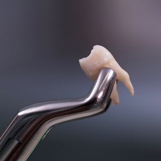 Extractions