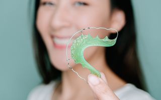 When can I stop wearing my retainers?