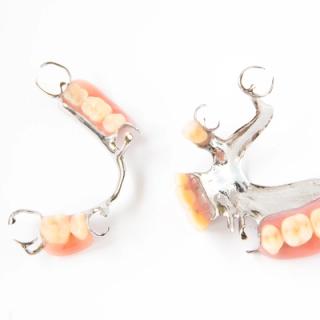 Image of a pair of partial dentures.