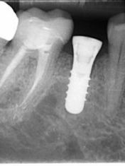 state of the art dental technology - 04