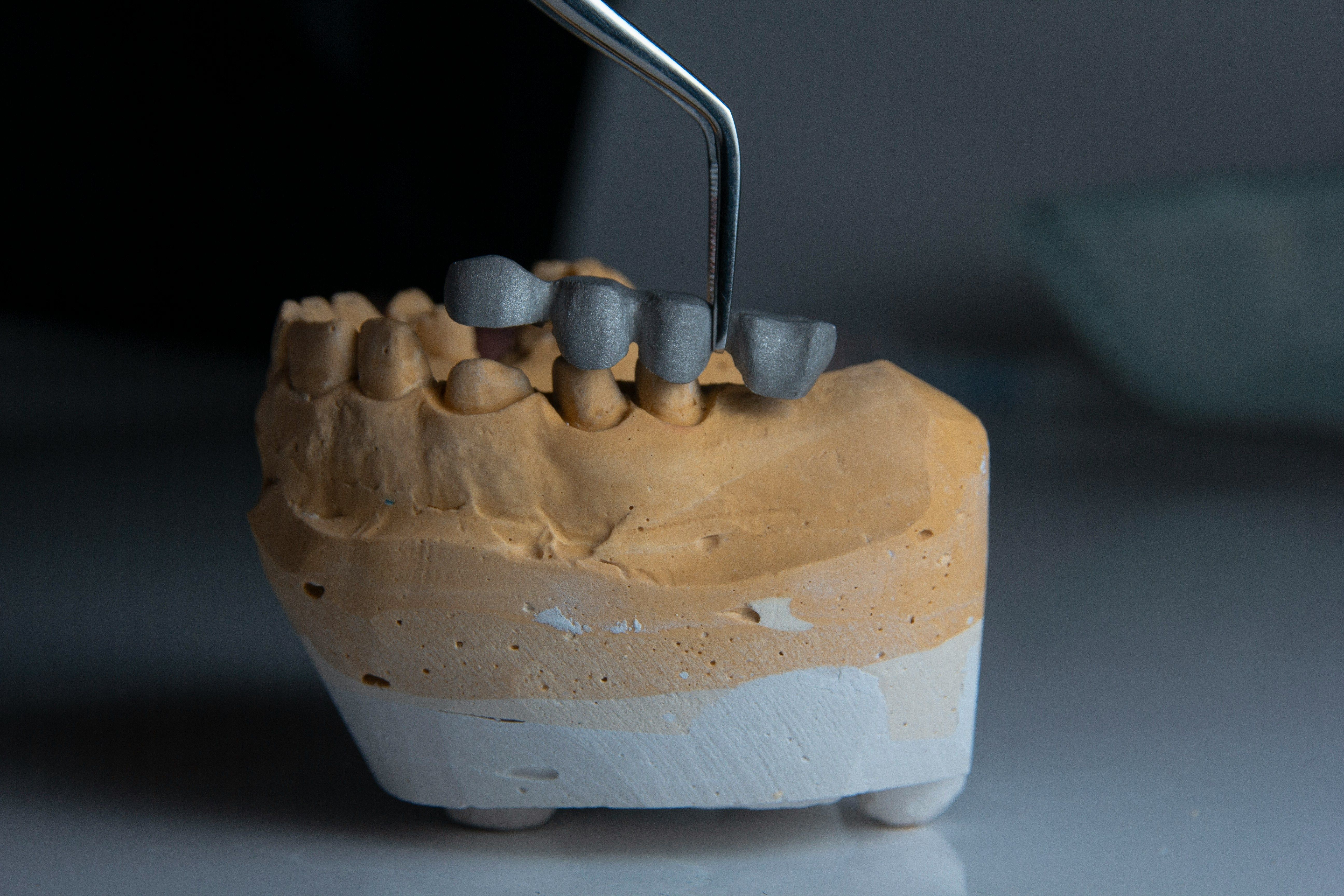 Do I Need a Root Canal?